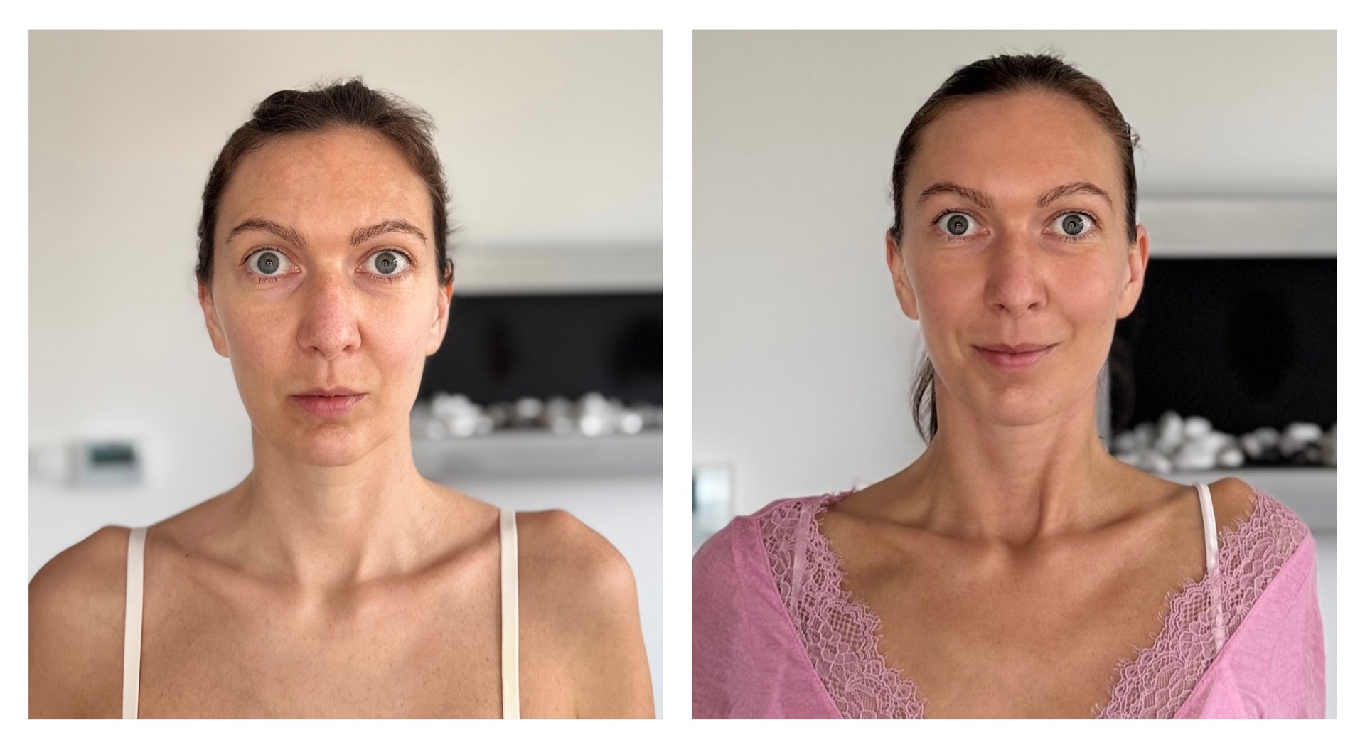 Pred - 2.4.2025 - po - 9.11.2025 - MUDr. Veronika Babic - Funkčné omladenie a modelácia tváre - portrétové fotografie