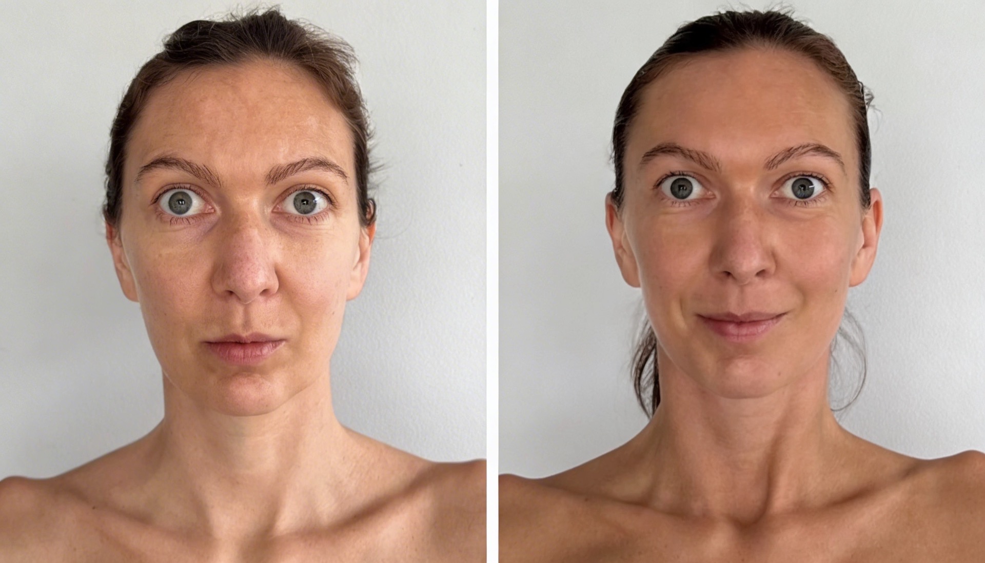 Na fotografii pred - vyhýbanie sa slnku, neustálne SPF, na fotografii po - po biologickom omladení, SPF minimálne